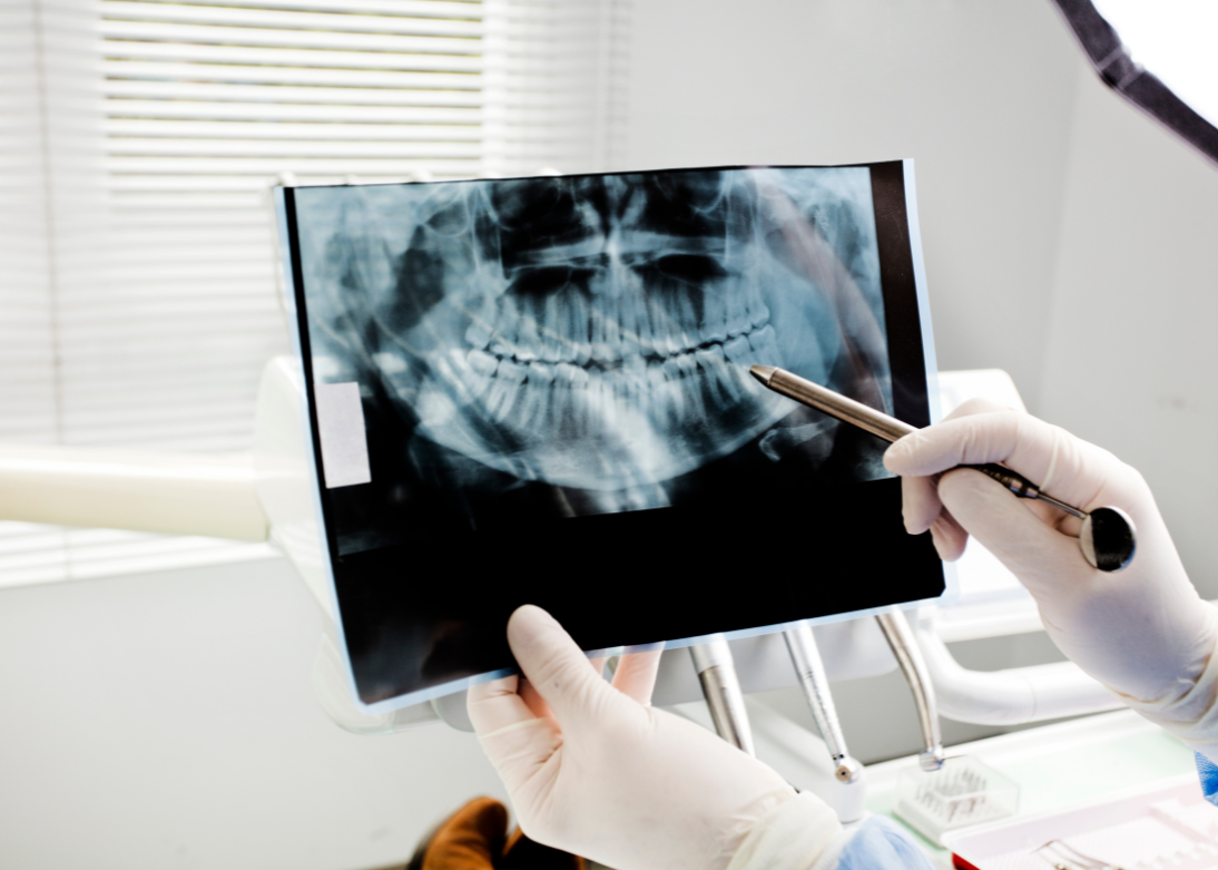 Oral Cancer Screening
