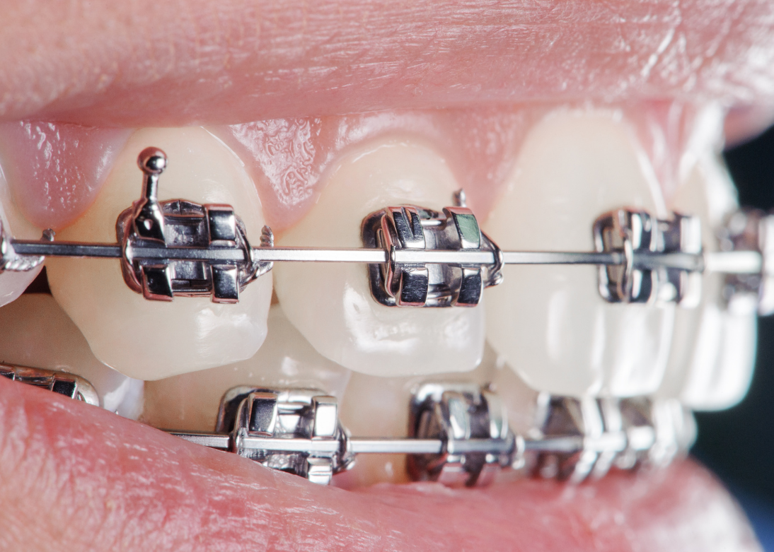 Orthodontic Services