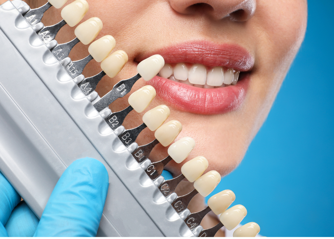 Cosmetic Dentistry